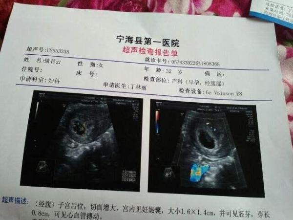 怀孕期间,孕妇应该避开的3大孕检"雷区",对胎儿发育有